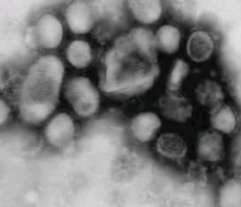 Genije ili luđak? Znanstvenik namjerno stvorio smrtonosni virus gripe!