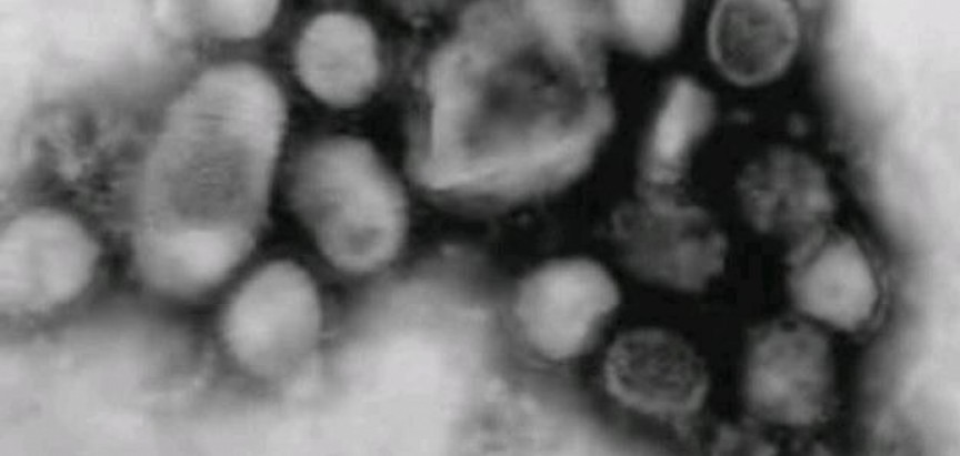 Genije ili luđak? Znanstvenik namjerno stvorio smrtonosni virus gripe!