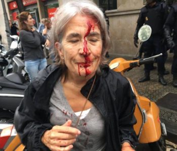 Krvavi referendum: U sukobima s policijom ozlijeđeno 465 ljudi