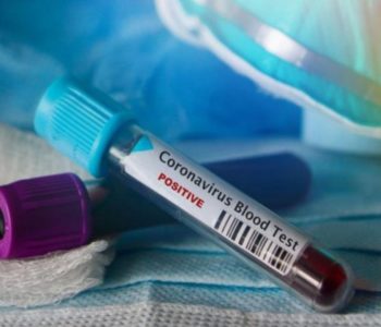 BiH nema reagense na testiranje koronavirusa