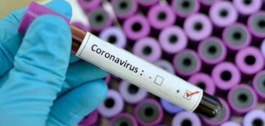 HNŽ Koronavirus potvrđen kod još sedam osoba