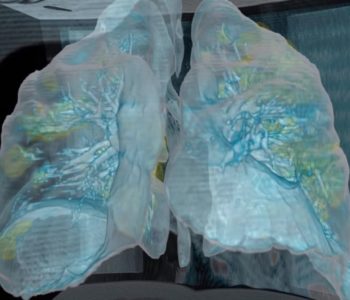 Američki liječnici objasnili na 3D videu šta se događa s plućima ljudi koji su zaraženi koronavirusom