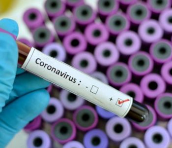 Dva nova slučaja zaraze koronavirusom u HNŽ-u, ukupno 86