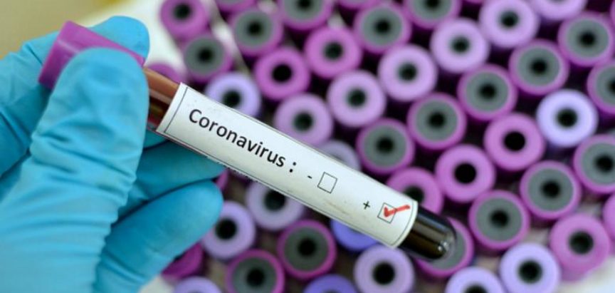 Dva nova slučaja zaraze koronavirusom u HNŽ-u, ukupno 86