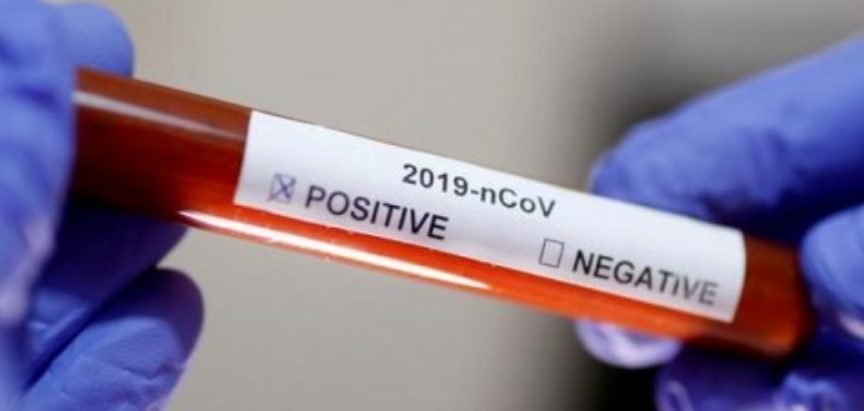 Jedna osoba iz Mostara pozitivna na koronavirus