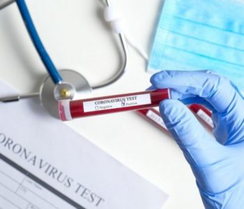ZA RAZMIŠLJANJE Skoro 4.000 Šveđana lažno pozitivno na koronavirus zbog testova iz Kine