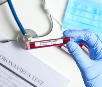 Nova cijena testa na koronavirus