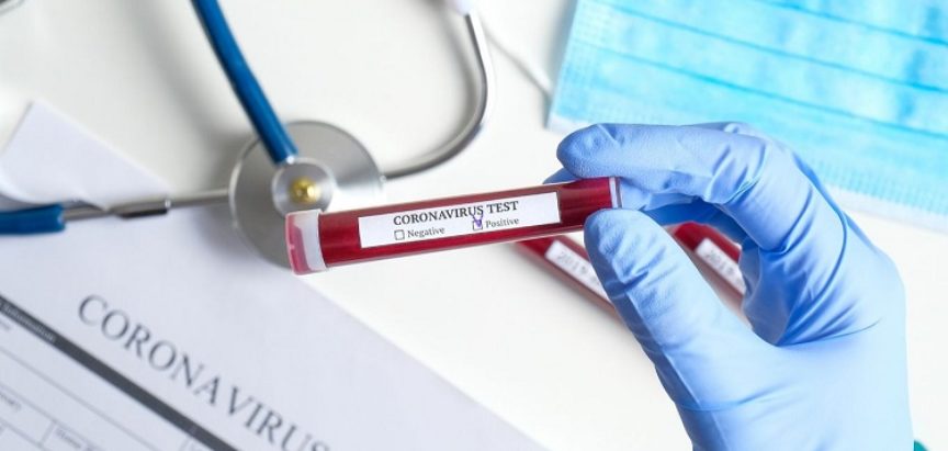 Nova cijena testa na koronavirus