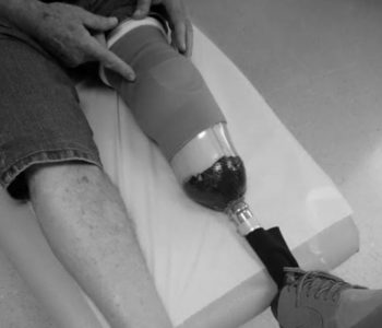 BANJA LUKA: Od osobe s invaliditetom ukrao protezu za nogu
