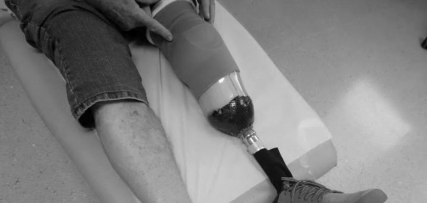 BANJA LUKA: Od osobe s invaliditetom ukrao protezu za nogu