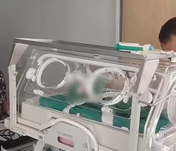 Liječnici bebu proglasili mrtvom, pogrebnik je spasio