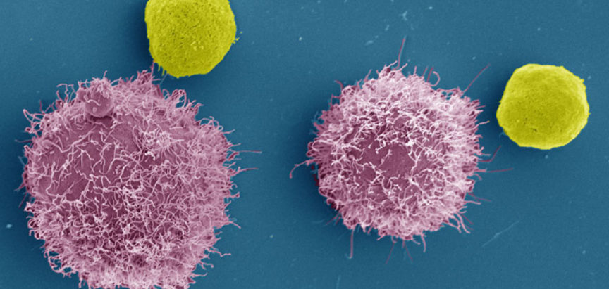 Cf33-hNIS: Testira se virus koji ubija rak