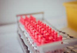 Gallerijev test otkriva više od 50 vrsta raka s nevjerojatnom točnošću