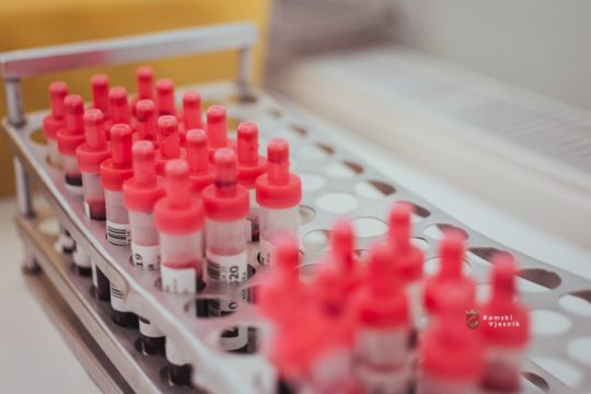 Japanski znanstvenici stvorili umjetnu krv koja odgovara svim krvnim grupama