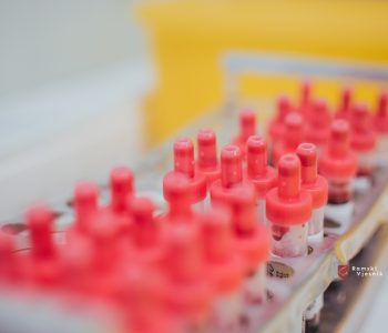 DOBRA VIJEST: Krv bi mogla otkriti rizik od raka prostate čak 15 godina ranije